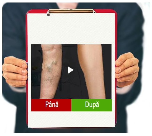 Discover fleboxin cena w aptece